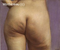 Etude de fesses